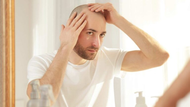 El tratamiento definitivo para la alopecia - Leclinics