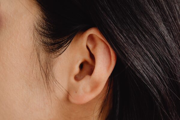 otoplastia para corregir orejas
