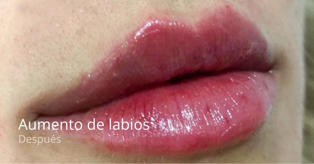 imgi_35_banner-e1679401891744