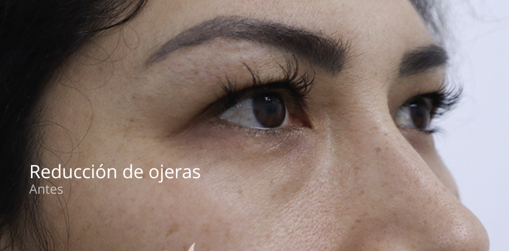 imgi_40_Leclinics-pagina-opiniones-2-e1679402424947