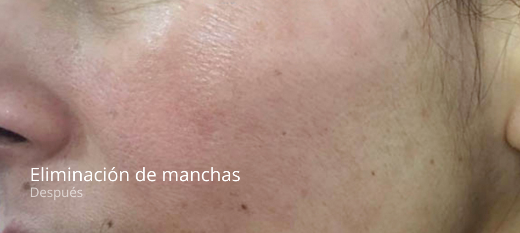 imgi_47_manchas-e1679402526177