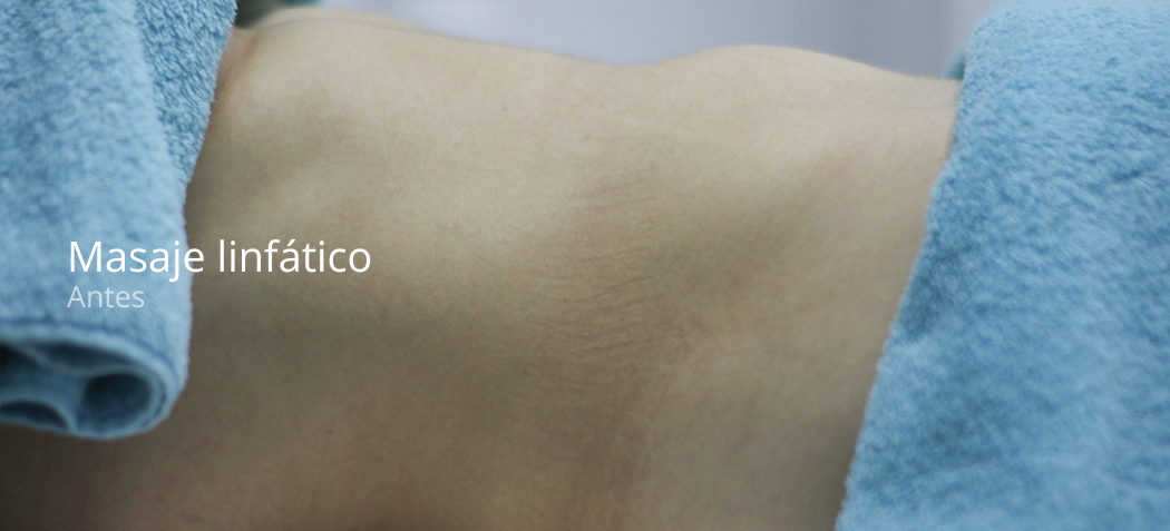 imgi_50_masaje-linfatico-e1679402883184